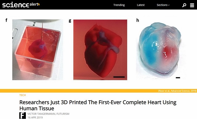自分の細胞でスペア臓器が作れる時代、ついに到来! 「3Dプリント心臓」の実験成功、ドナーに頼らない臓器移植へ!の画像1